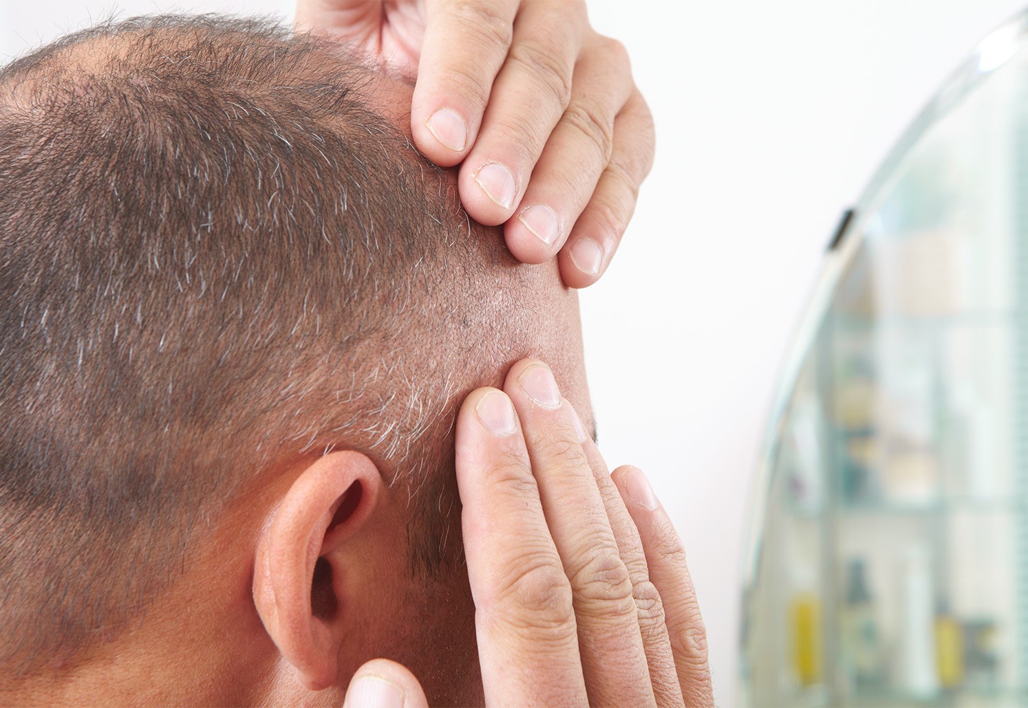 Parcours de soin pour la greffe de cheveux - Greffe de cheveux à Paris