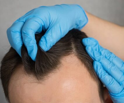La greffe de cheveux présente-t-elle des risques ? | Paris | Centre de Greffe de cheveux