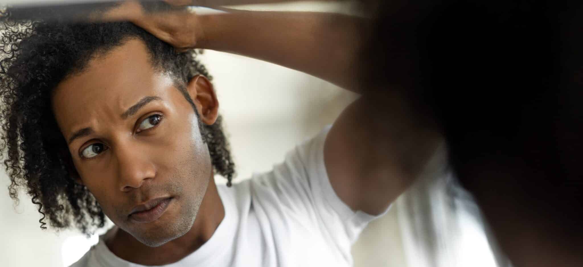 Calvitie précoce : la reconnaître et la traiter | Paris | Centre de Greffe de cheveux