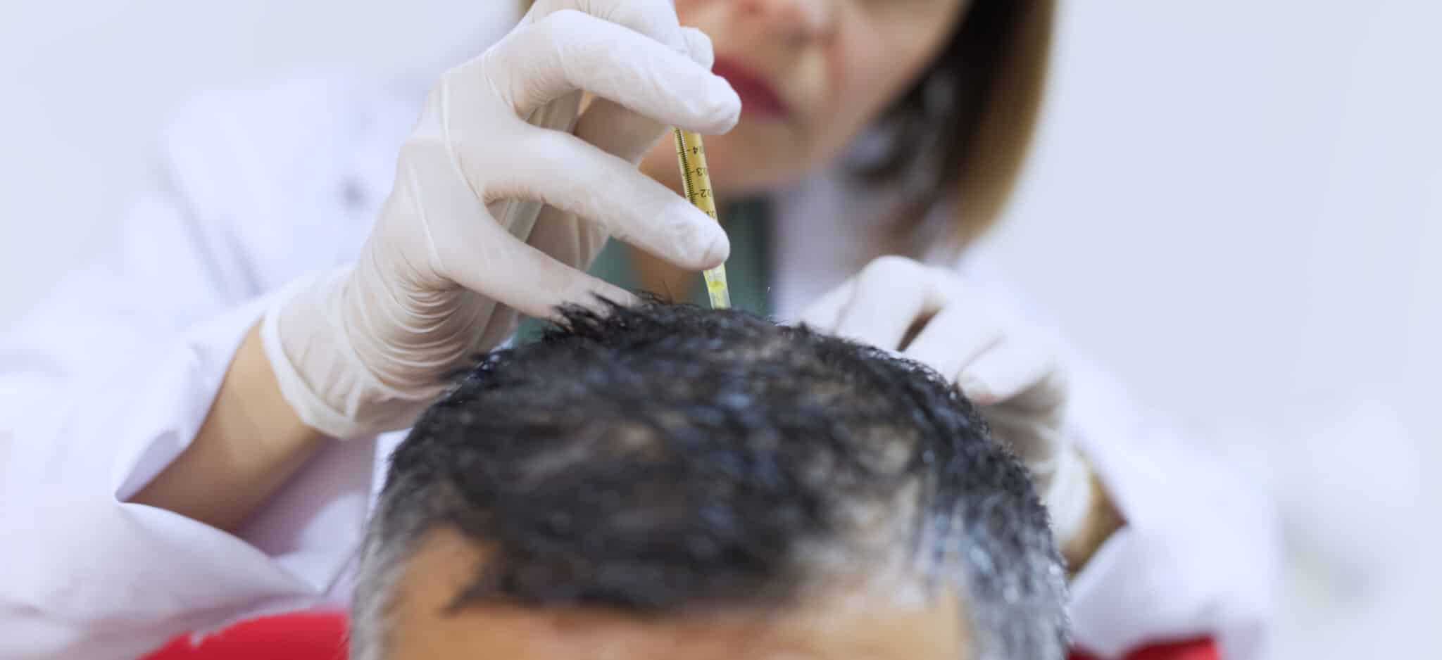 exosome greffe cheveux améliorer prise implants | Paris | Centre de Greffe de cheveux