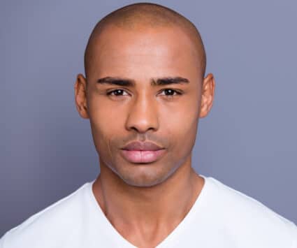 Peut-on réaliser deuxième greffe cheveux première insuffisante | Paris | Centre de Greffe de cheveux